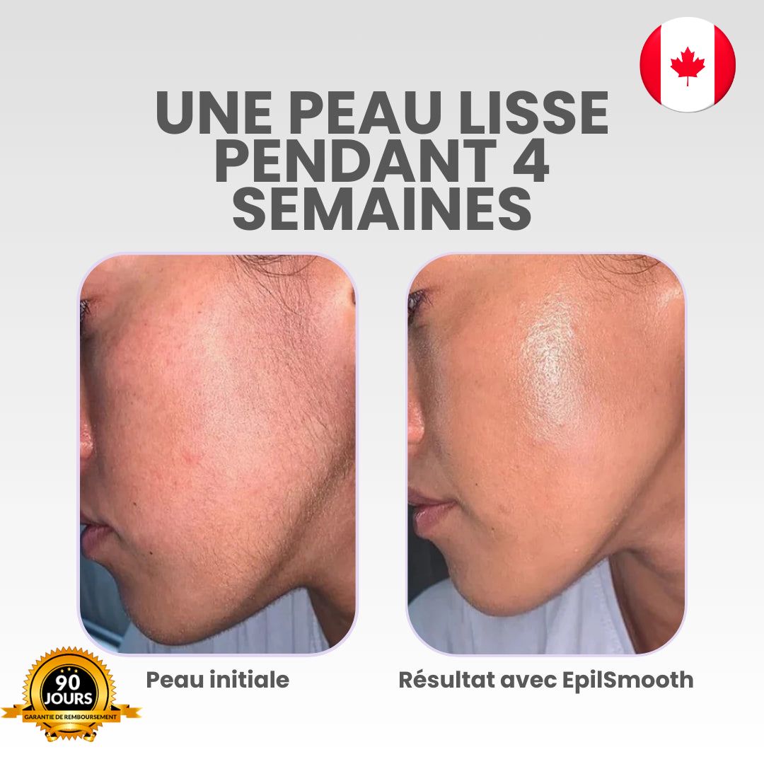 Épilateur visage EpilSmooth⎪Luvanna