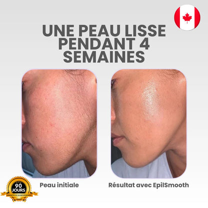 Épilateur visage EpilSmooth⎪Luvanna